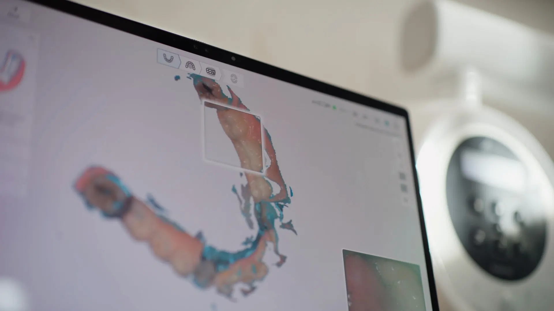 A 3D scan of a dental arch on a monitor