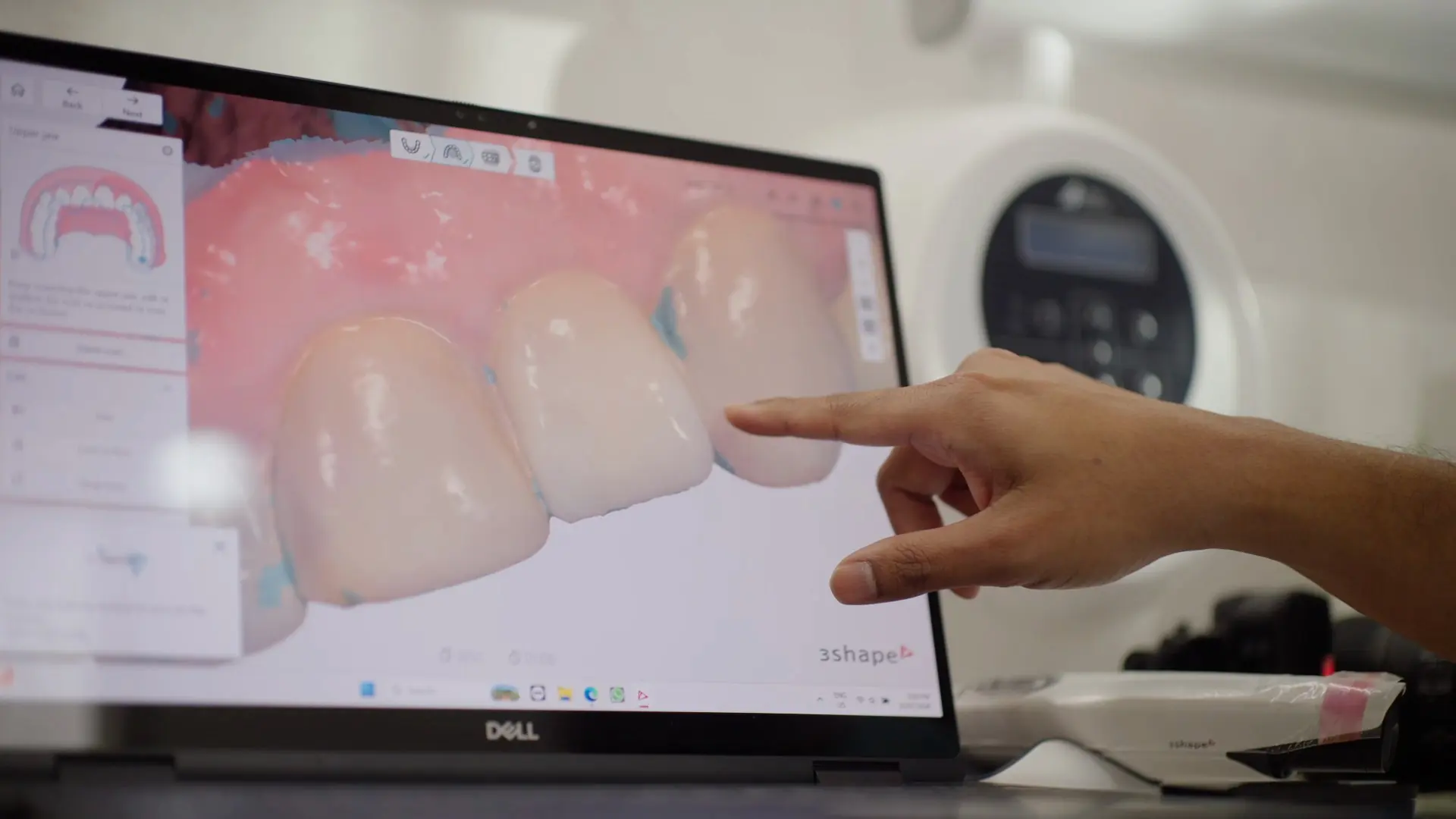 A digital design of front teeth on screen, with a finger pointing at one tooth