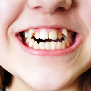 crooked-img-pg