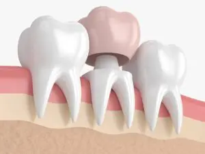 crowns-img
