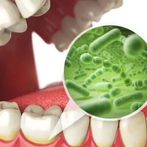 gum-diseases-ser-img