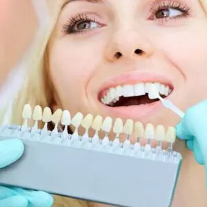 veneers-counter-4