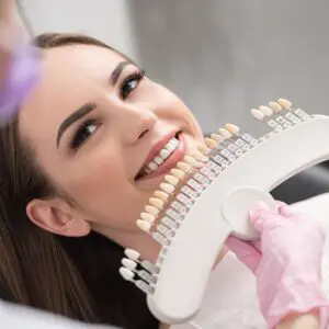 veneers-img-ser